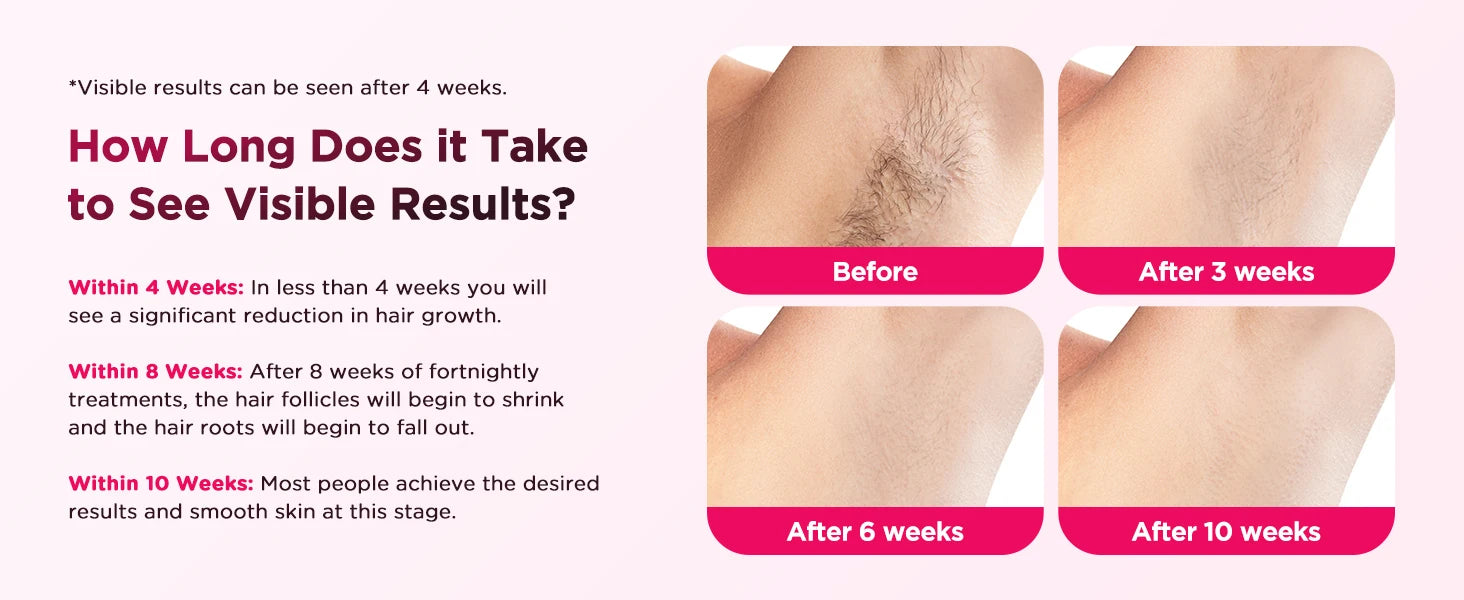 Flash Laser Epilator IPL Hair Removal For Men and Women Body Bikini Facial  Permanant Painless IPL Hair Remover Machine
